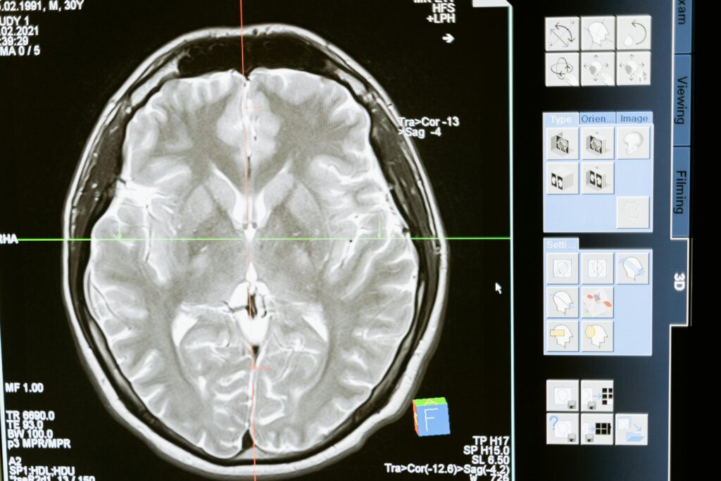 Une vision du changement par la neurologie 2 pexels mart production 7089020